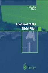 Fractures of the tibial pilon. Ediz. inglese