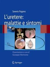 L'uretere. Malattie e sintomi