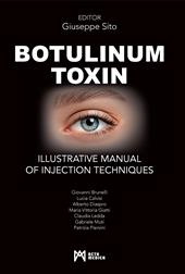 Botulinum toxin. Ilustrative manual of injection techniques. Ediz. a colori